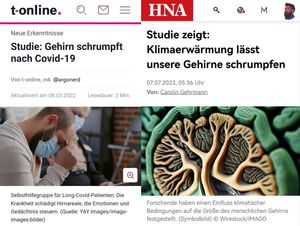 Schrumpfende Gehirne